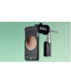 SMART SCOPE